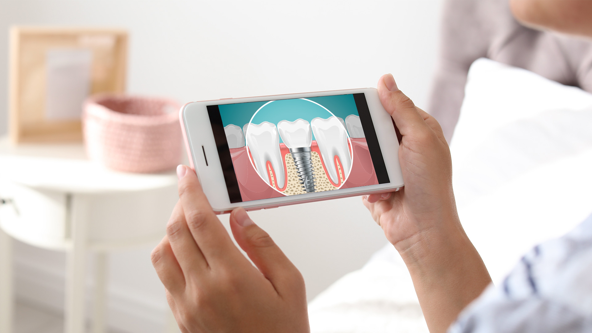 Person holding smartphone displaying dental implant simulation.